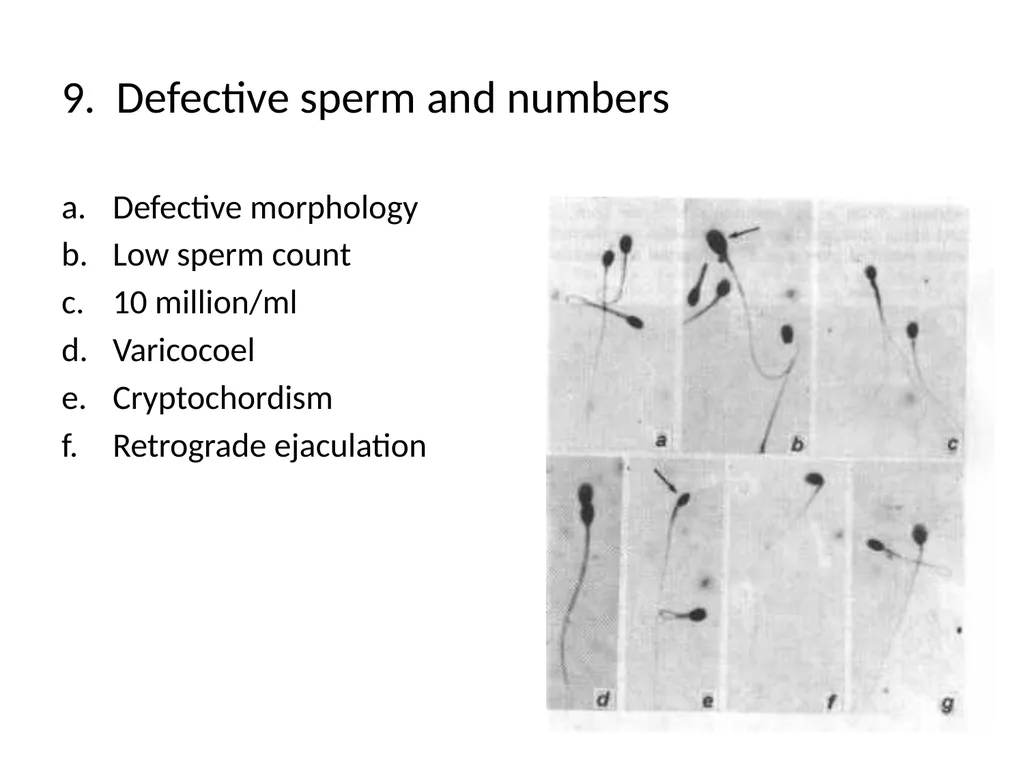 Reproductive Biology I. Need for Meiosis A. Human - slide 8 of 33