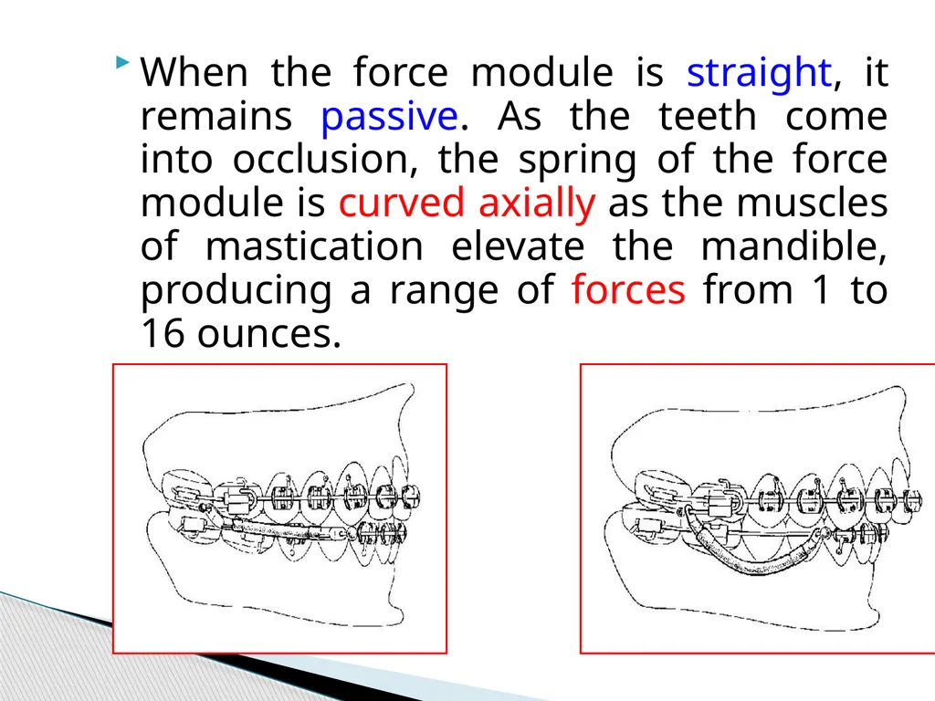 Fixed Functional Appliances Introduction - slide 29 of 48