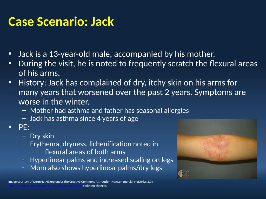 Faculty David I. Bernstein, MD Professor of - slide 17 of 76