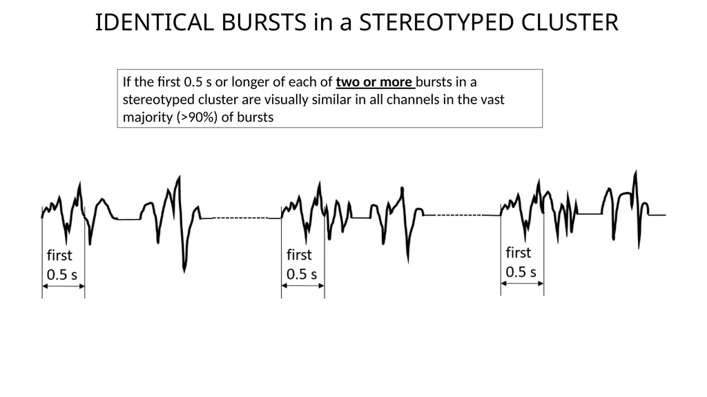 ACNS Critical Care EEG Terminology Training Module - slide 25 of 41