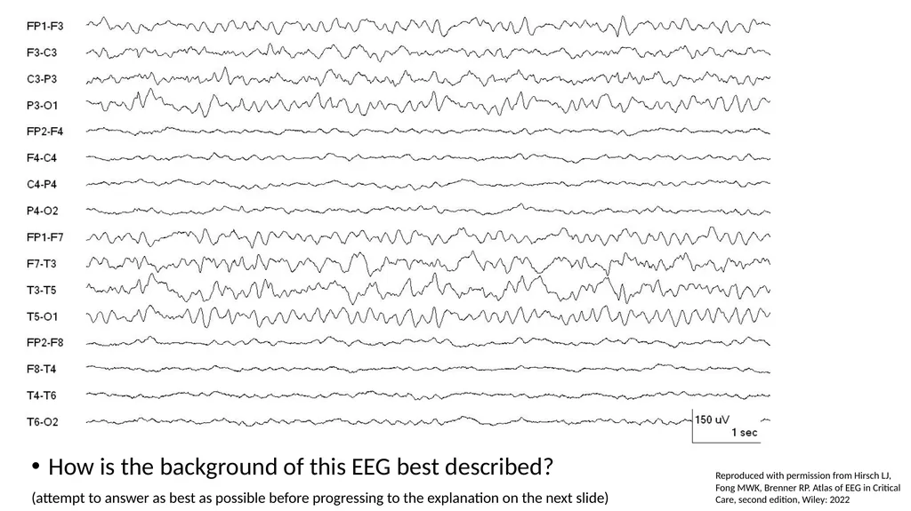 ACNS Critical Care EEG Terminology Training Module - slide 9 of 41