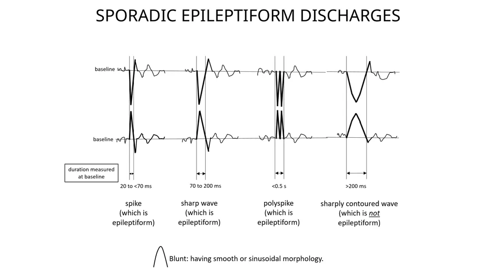 ACNS Critical Care EEG Terminology Training Module - slide 37 of 41