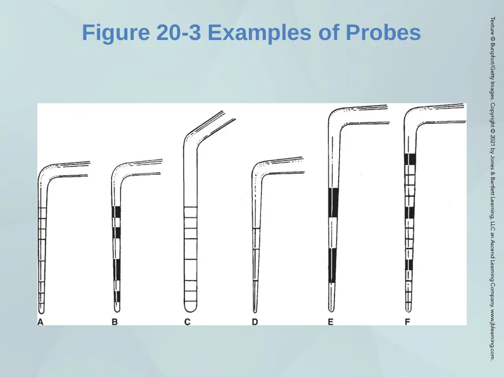 Chapter 20 Periodontal Examination Learning - slide 16 of 49