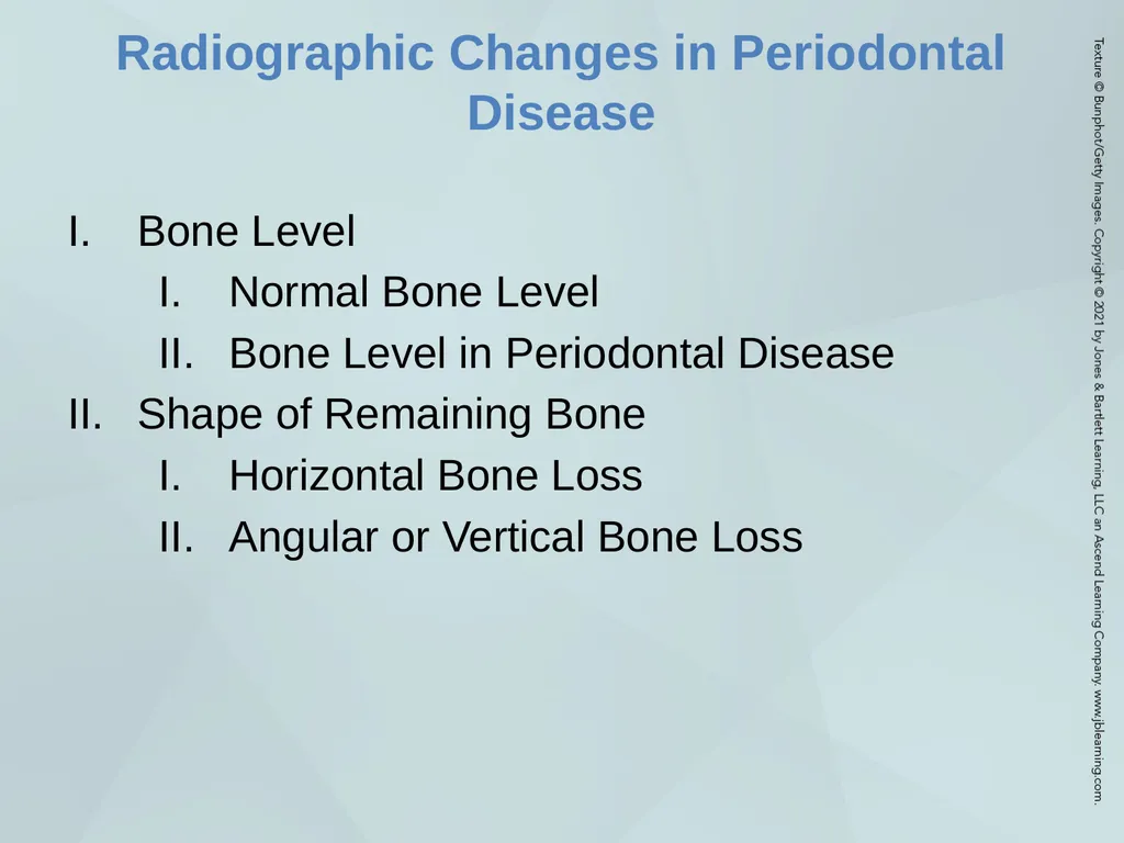 Chapter 20 Periodontal Examination Learning - slide 41 of 49