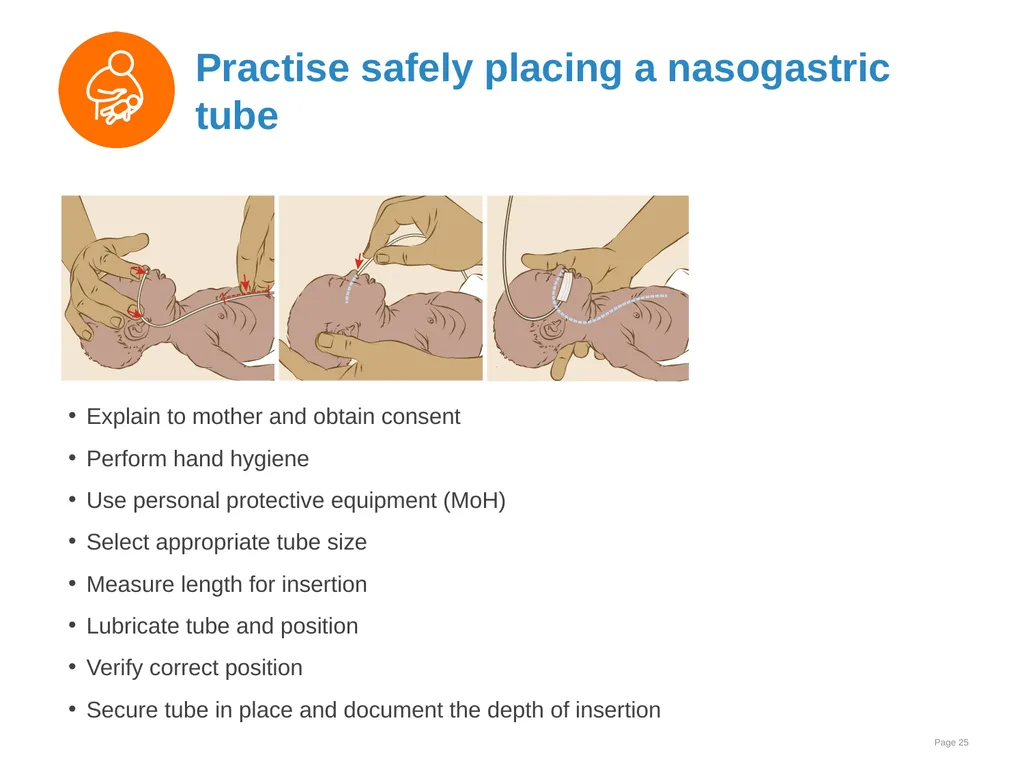 Breast milk feeding: Alternative methods Goal and - slide 25 of 54