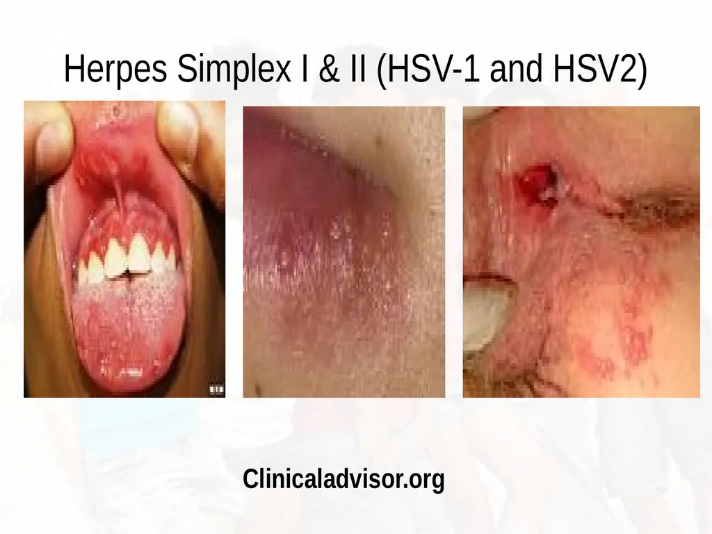 Commonly Seen Infectious and Non-Infectious Skin - slide 48 of 86