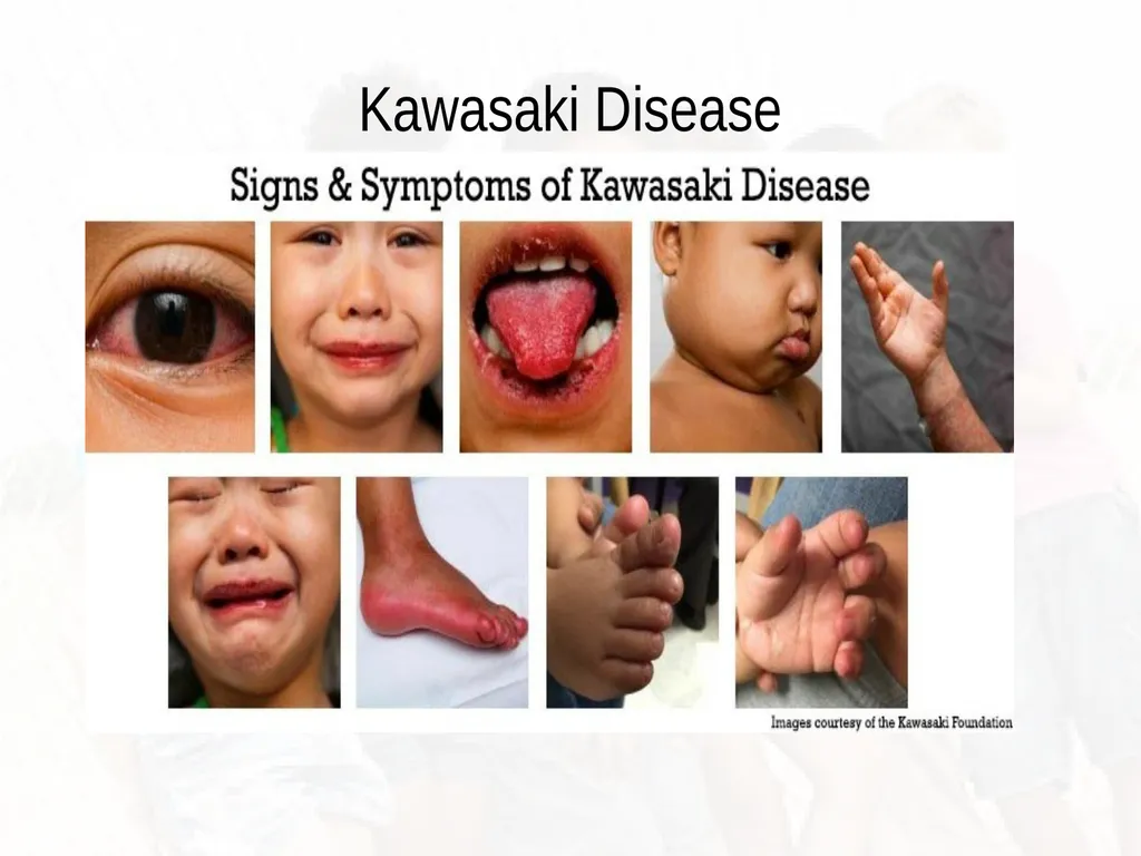 Commonly Seen Infectious and Non-Infectious Skin - slide 71 of 86