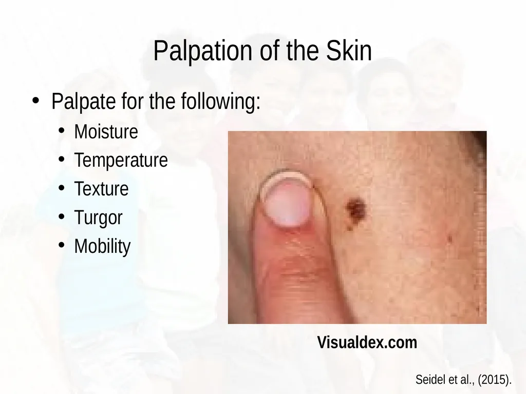 Commonly Seen Infectious and Non-Infectious Skin - slide 14 of 86