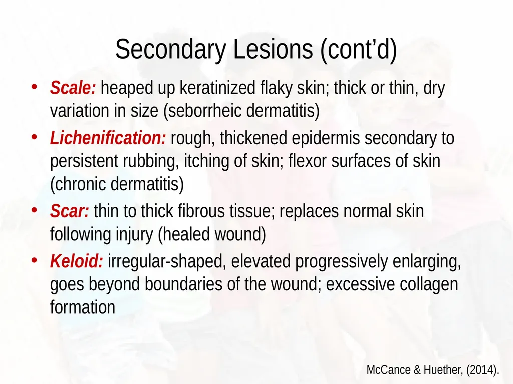 Commonly Seen Infectious and Non-Infectious Skin - slide 21 of 86