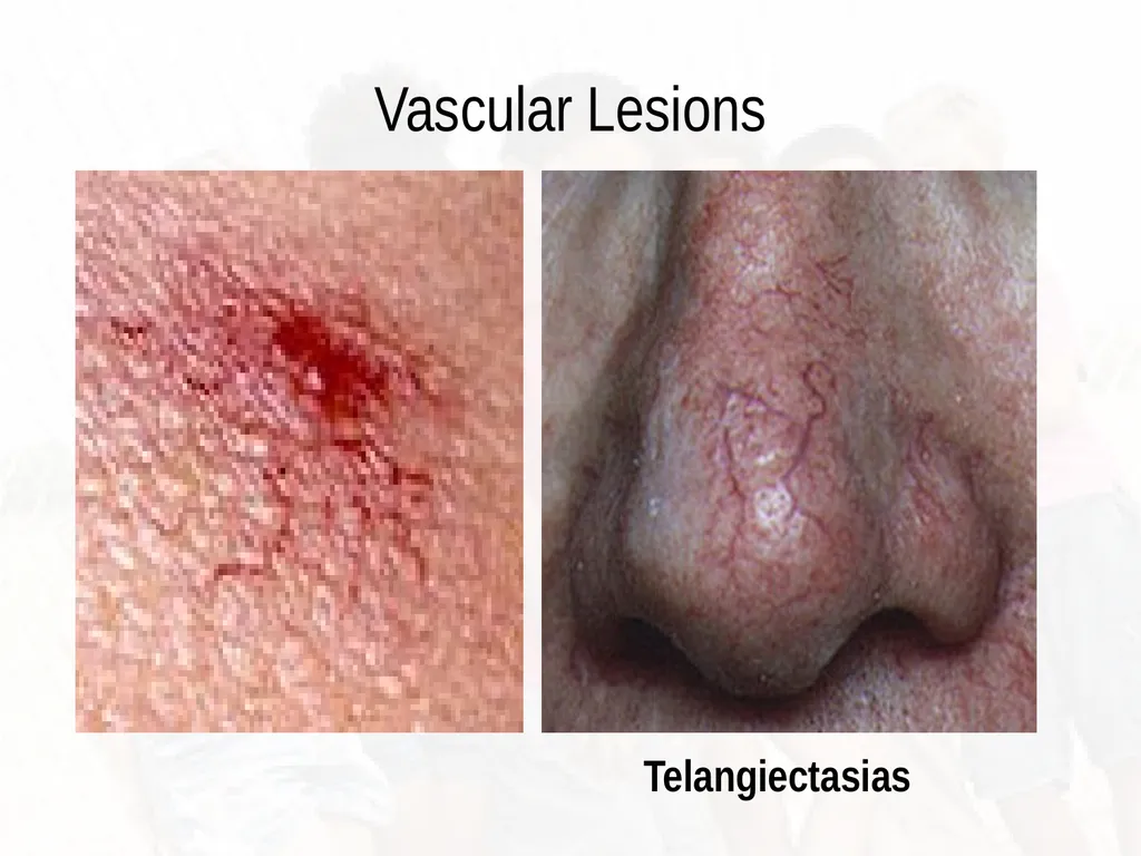 Commonly Seen Infectious and Non-Infectious Skin - slide 24 of 86