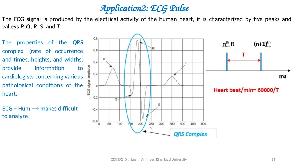 Chapter 7 Digital Filter Design CEN352, Dr. Nassim - slide 33 of 37