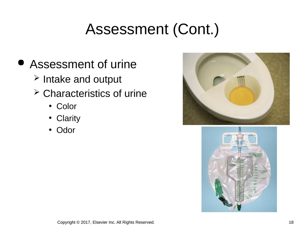 Chapter 46 Urinary Elimination Copyright © 2017, - slide 18 of 39