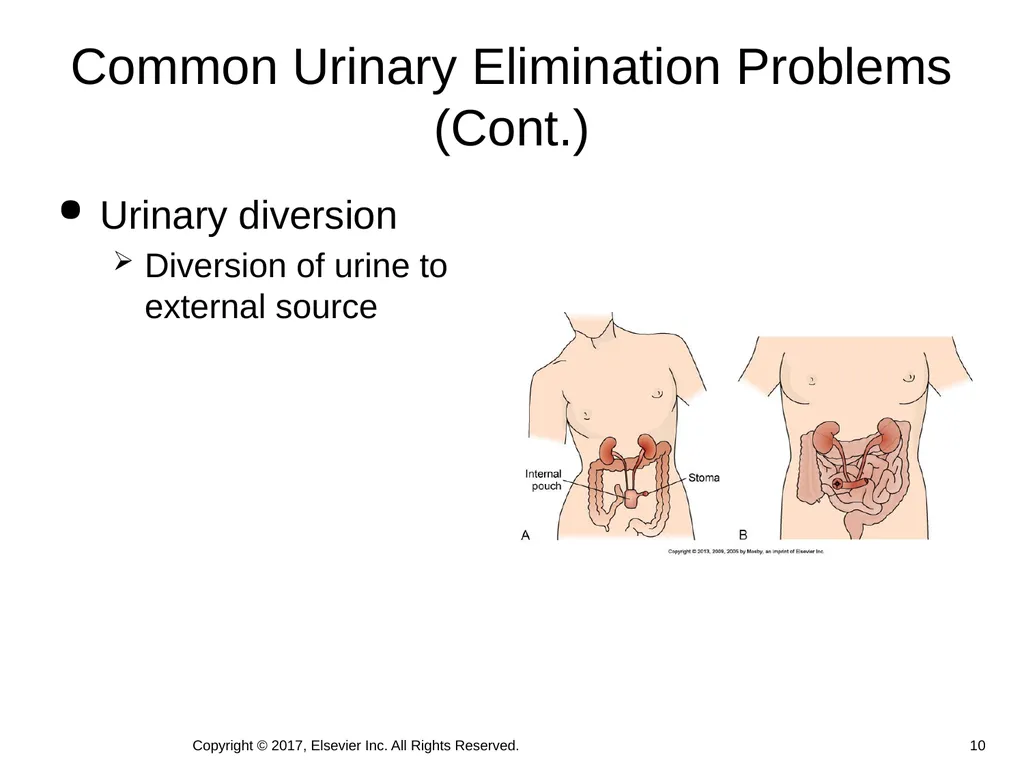 Chapter 46 Urinary Elimination Copyright © 2017, - slide 10 of 39