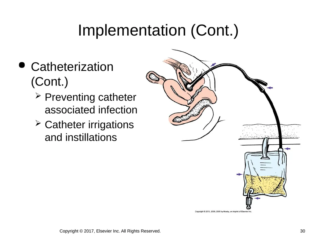 Chapter 46 Urinary Elimination Copyright © 2017, - slide 30 of 39