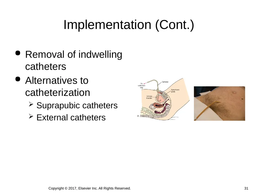 Chapter 46 Urinary Elimination Copyright © 2017, - slide 31 of 39