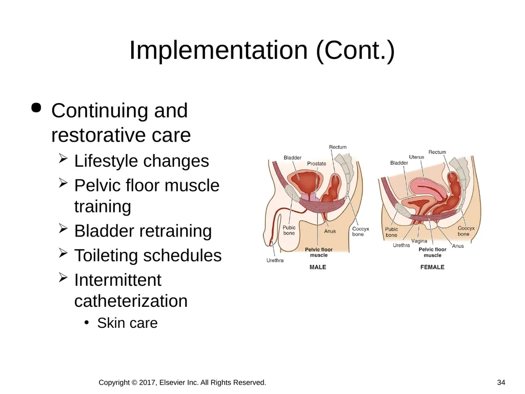 Chapter 46 Urinary Elimination Copyright © 2017, - slide 34 of 39