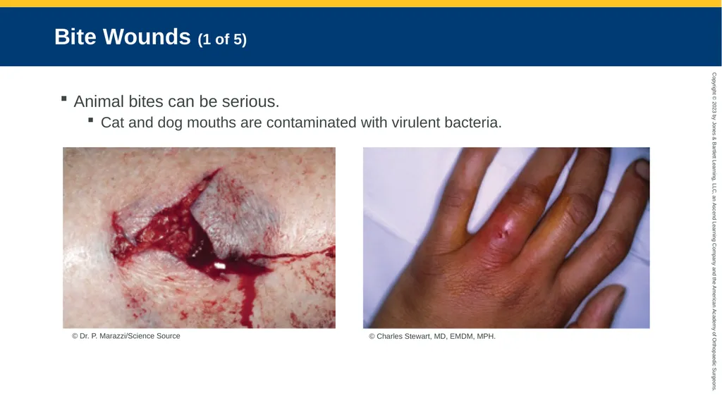 Soft-Tissue Trauma CHAPTER 32 Introduction The - slide 85 of 105
