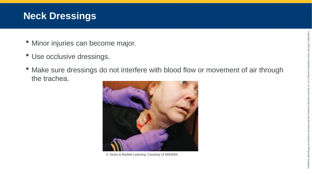 Soft-Tissue Trauma CHAPTER 32 Introduction The - slide 61 of 105