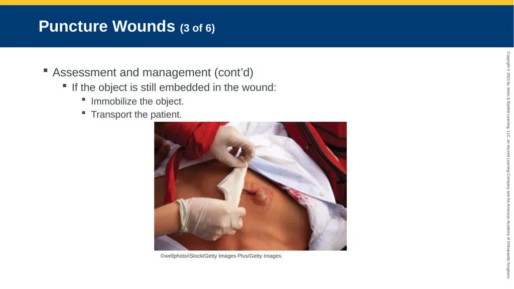 Soft-Tissue Trauma CHAPTER 32 Introduction The - slide 75 of 105