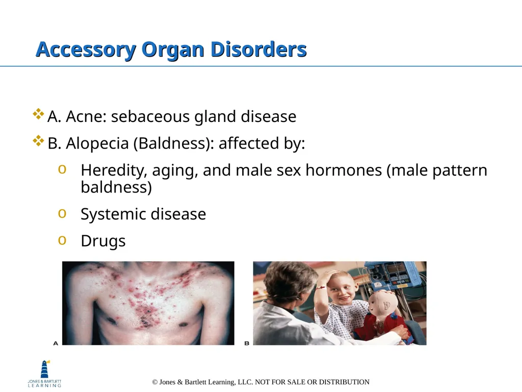 Chapter 6: The Integumentary System Overview Key - slide 71 of 84