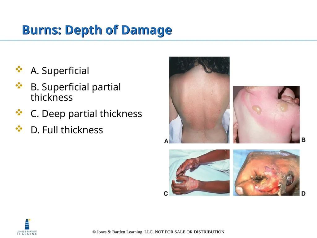 Chapter 6: The Integumentary System Overview Key - slide 63 of 84