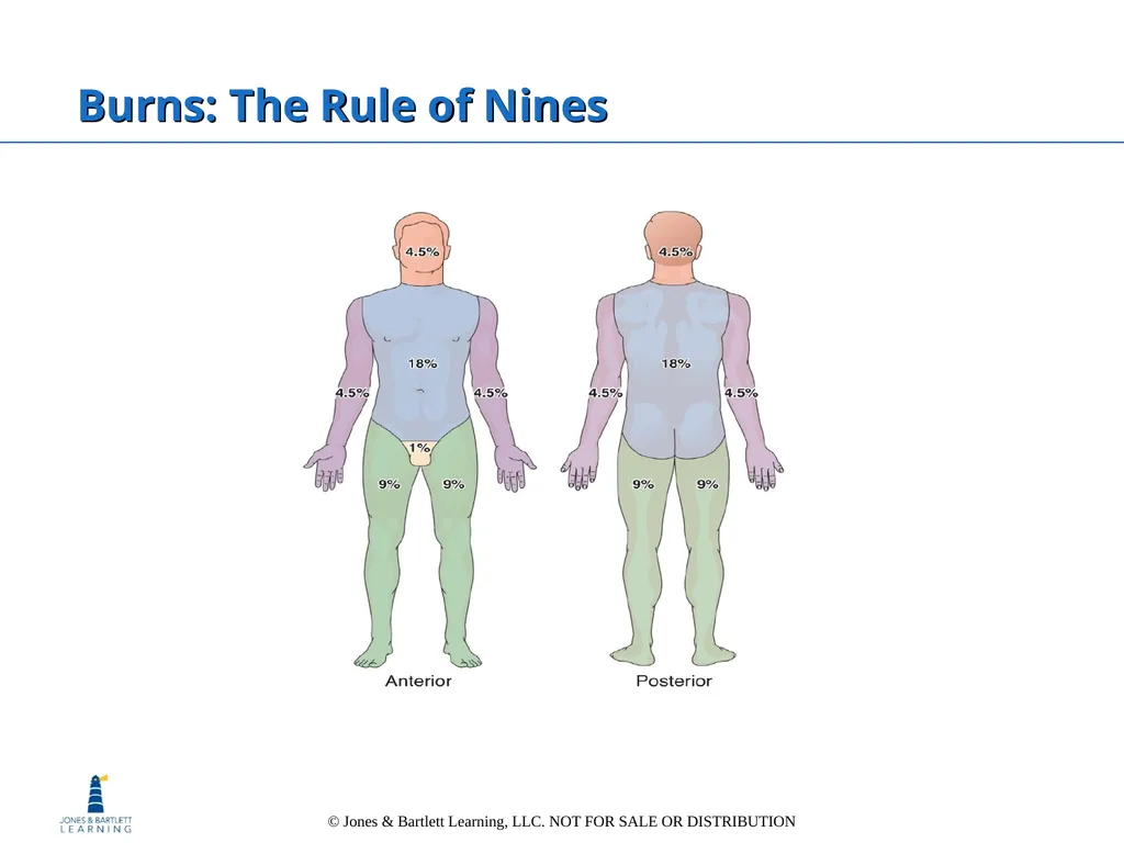 Chapter 6: The Integumentary System Overview Key - slide 64 of 84