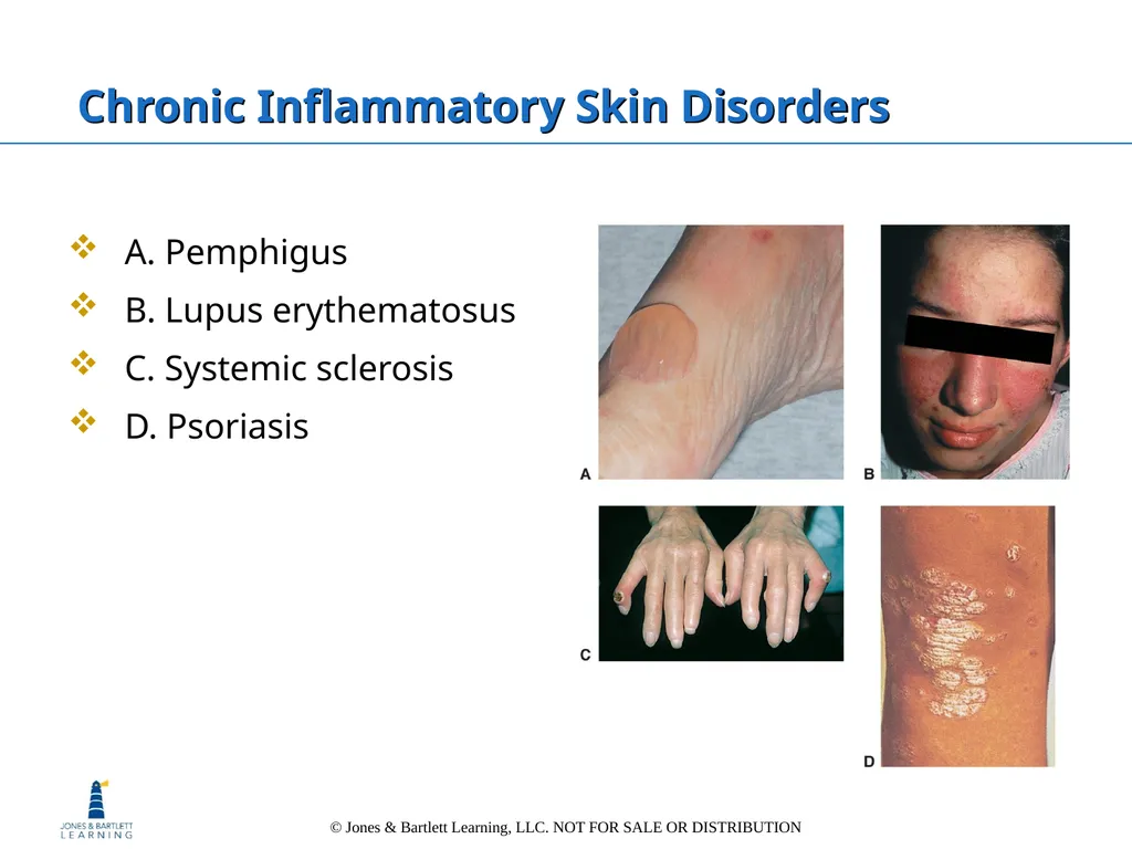 Chapter 6: The Integumentary System Overview Key - slide 70 of 84