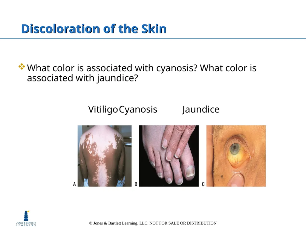 Chapter 6: The Integumentary System Overview Key - slide 47 of 84