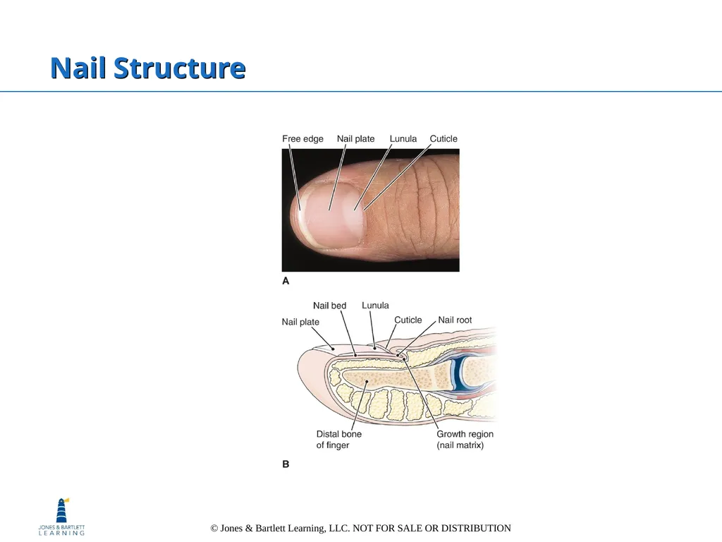 Chapter 6: The Integumentary System Overview Key - slide 29 of 84