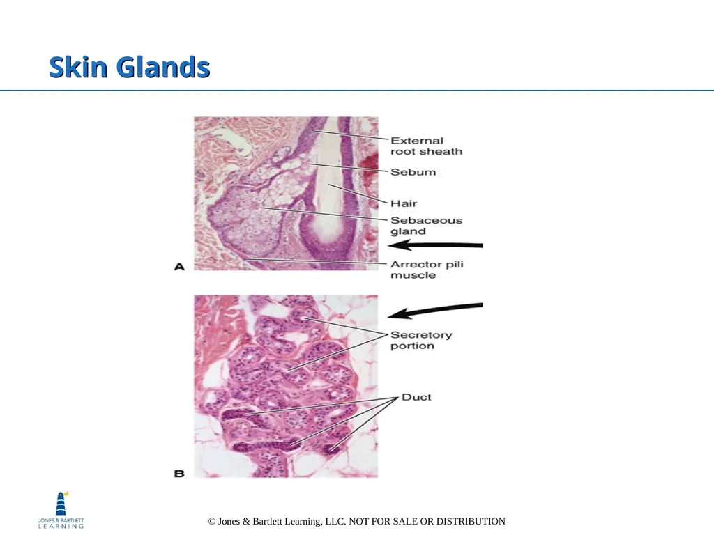 Chapter 6: The Integumentary System Overview Key - slide 28 of 84
