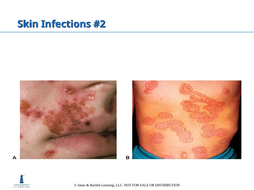 Chapter 6: The Integumentary System Overview Key - slide 67 of 84