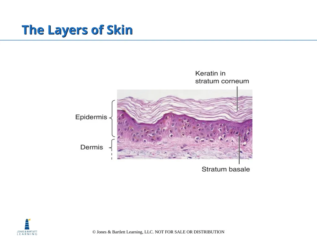 Chapter 6: The Integumentary System Overview Key - slide 21 of 84