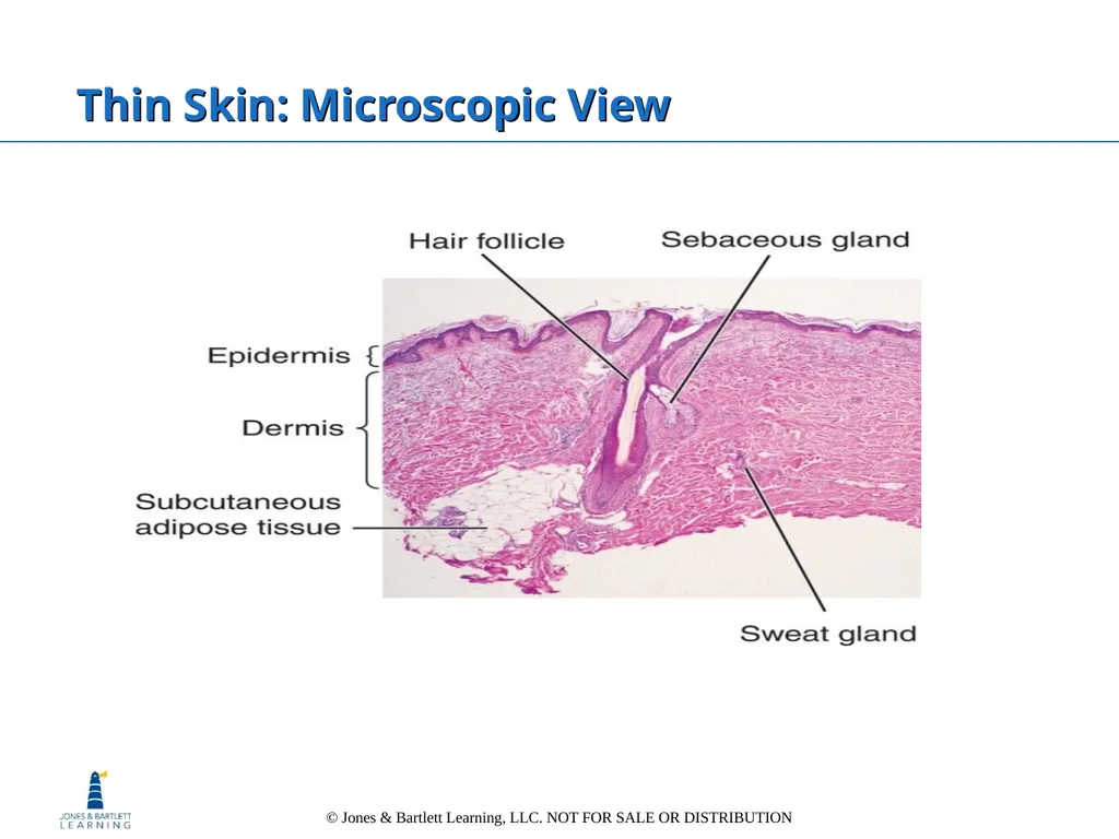 Chapter 6: The Integumentary System Overview Key - slide 20 of 84