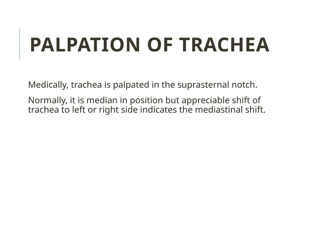 Trachea BY MBBSPPT.COM The Trachea is also called - slide 26 of 32
