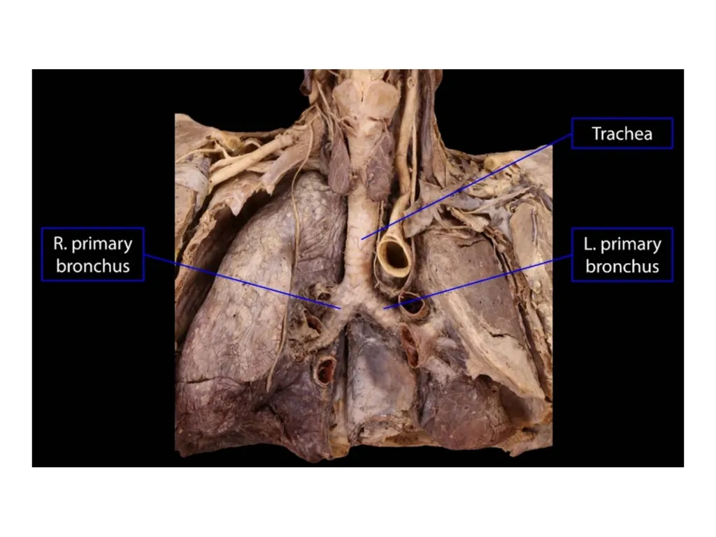Trachea BY MBBSPPT.COM The Trachea is also called - slide 2 of 32