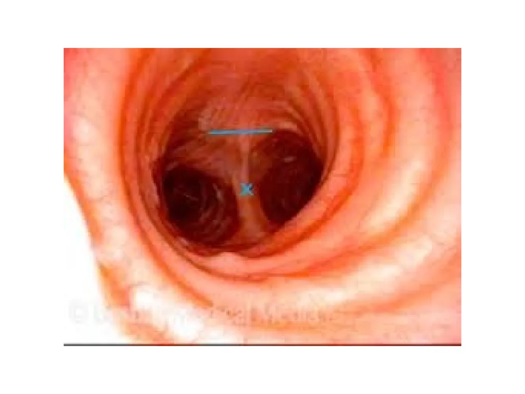 Trachea BY MBBSPPT.COM The Trachea is also called - slide 27 of 32