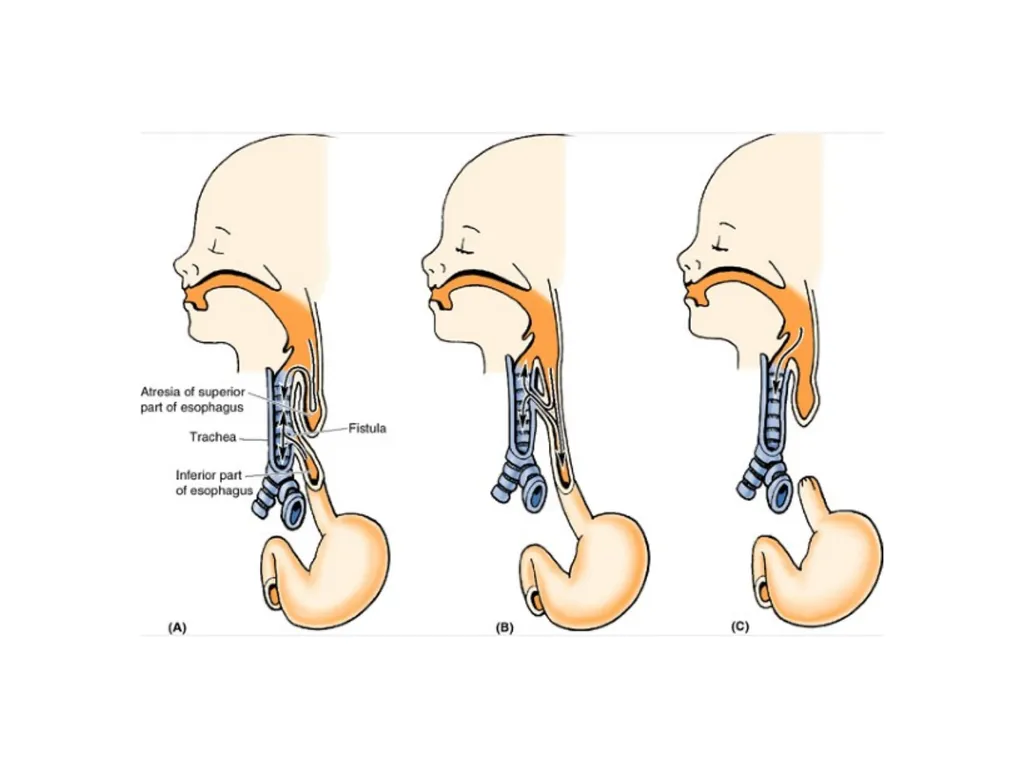 Trachea BY MBBSPPT.COM The Trachea is also called - slide 29 of 32