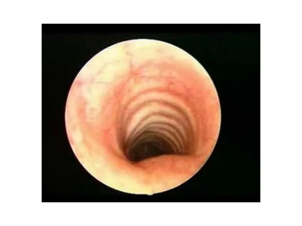 Trachea BY MBBSPPT.COM The Trachea is also called - slide 7 of 32