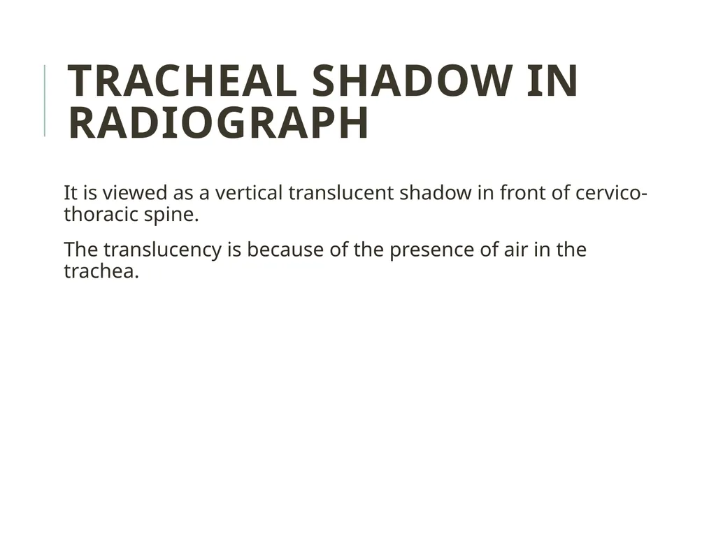 Trachea BY MBBSPPT.COM The Trachea is also called - slide 24 of 32