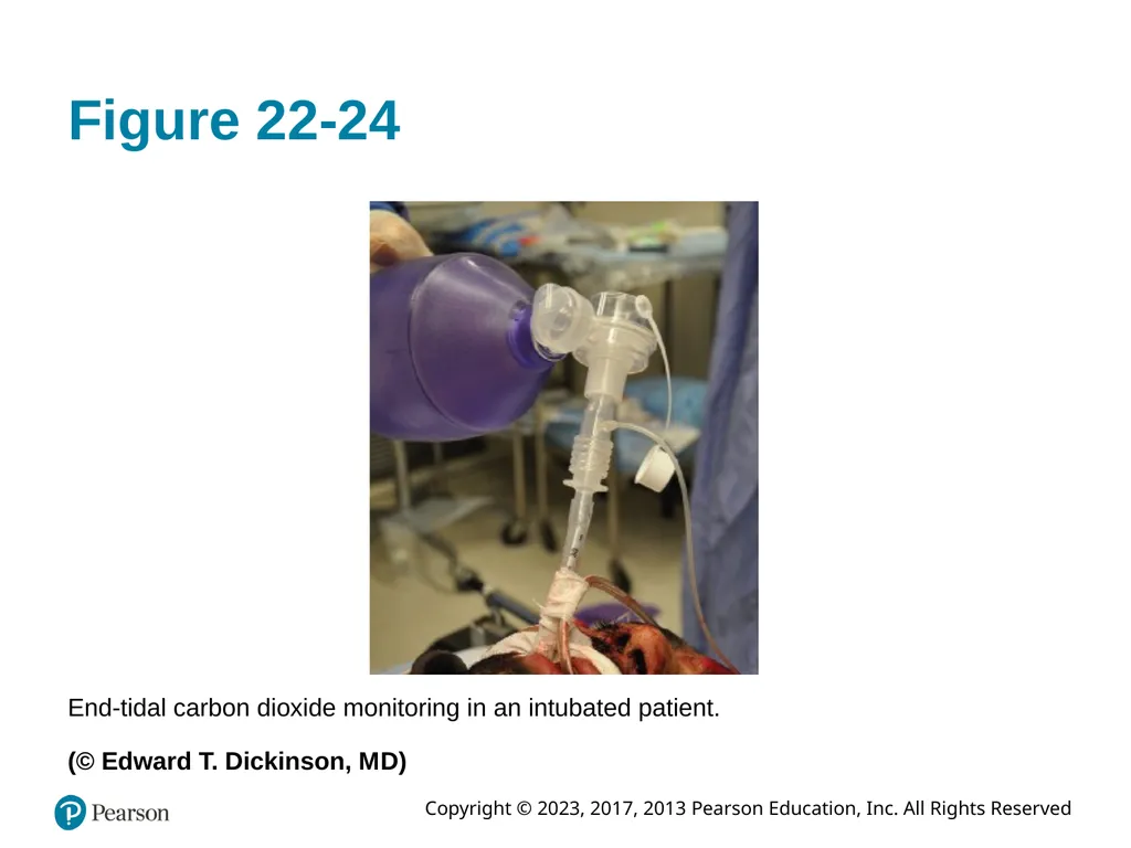 Paramedic Care: Principles & Practice Sixth - slide 69 of 87