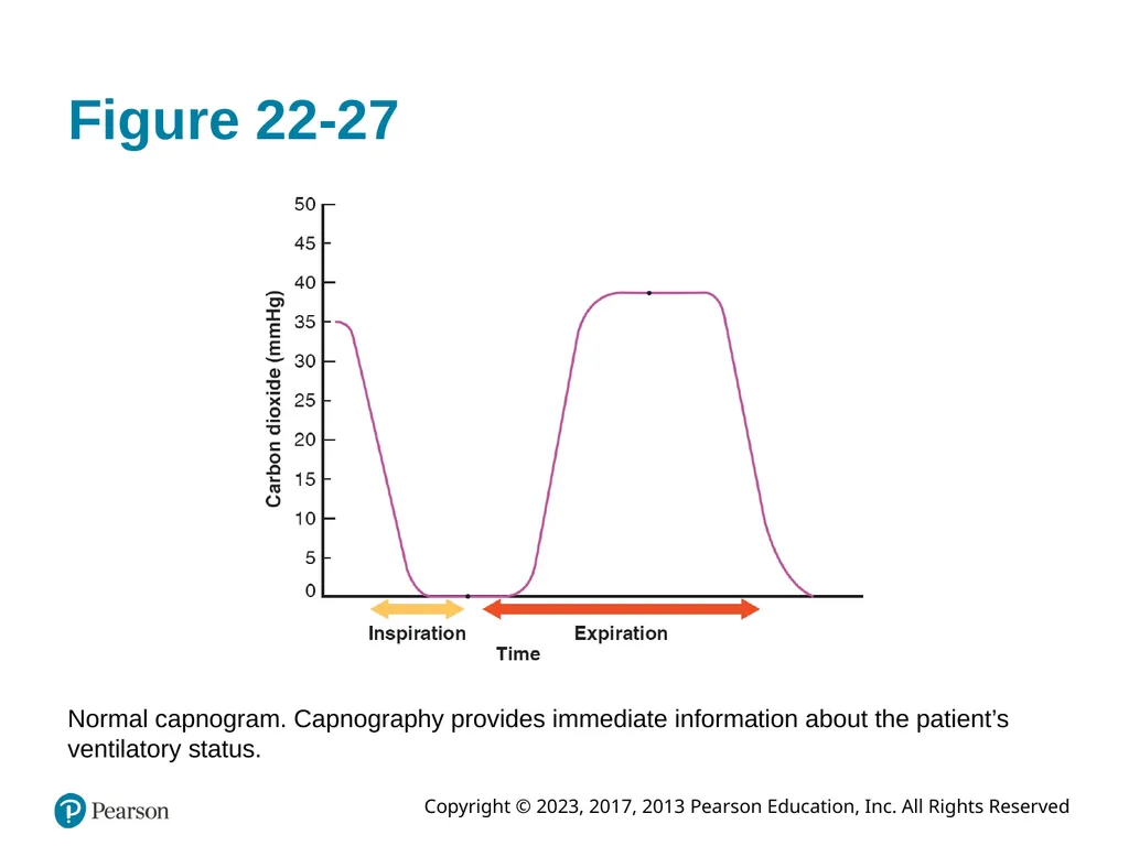 Paramedic Care: Principles & Practice Sixth - slide 75 of 87