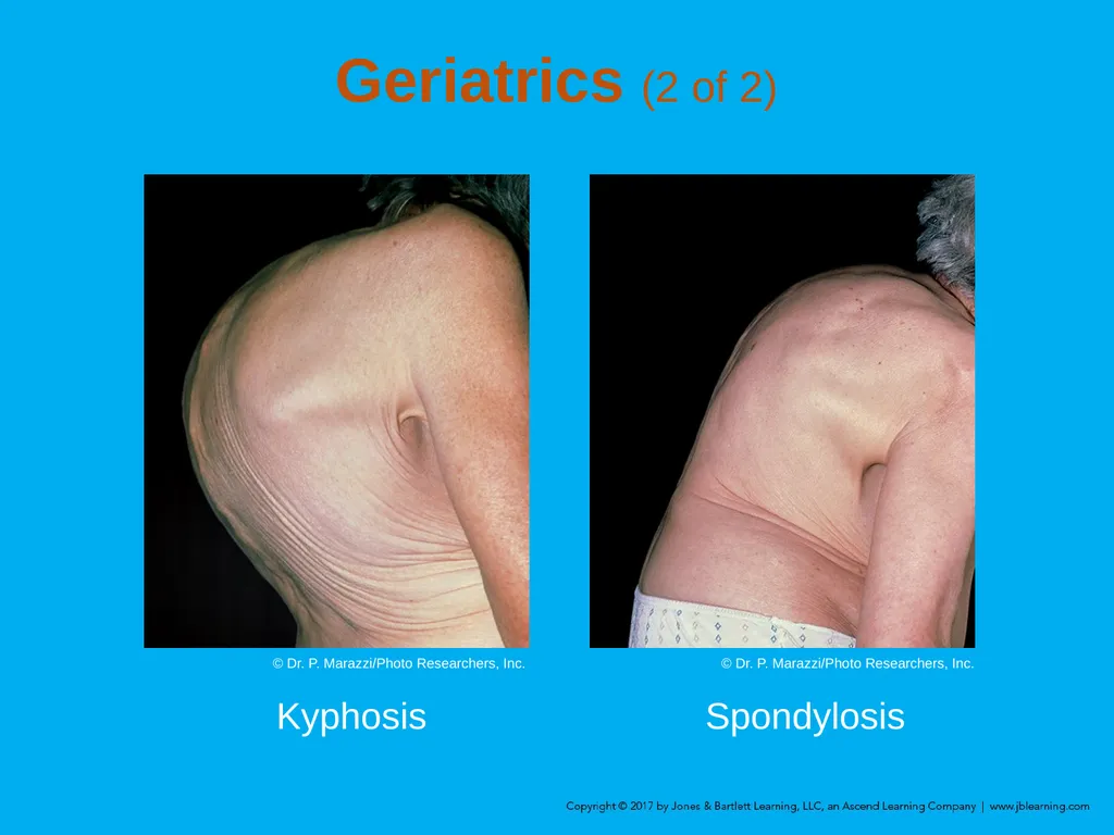 Chapter 8 Lifting and Moving Patients Introduction - slide 36 of 91