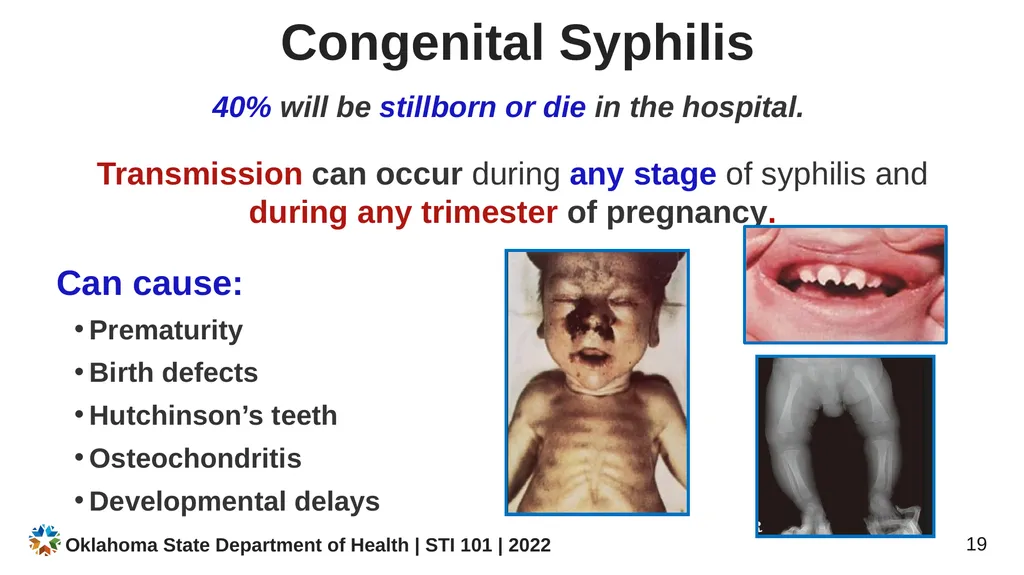 STI/STD STI/STD: True or False? You CANNOT get an - slide 19 of 34
