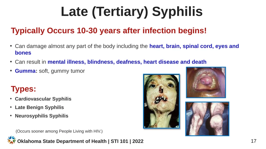 STI/STD STI/STD: True or False? You CANNOT get an - slide 17 of 34