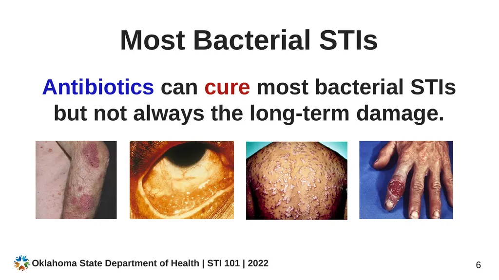 STI/STD STI/STD: True or False? You CANNOT get an - slide 6 of 34