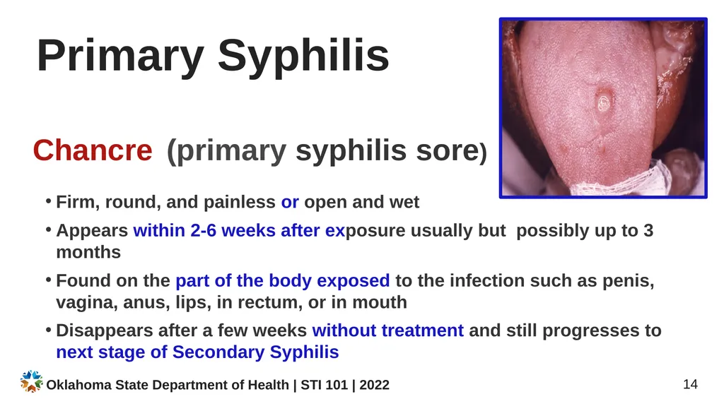 STI/STD STI/STD: True or False? You CANNOT get an - slide 14 of 34
