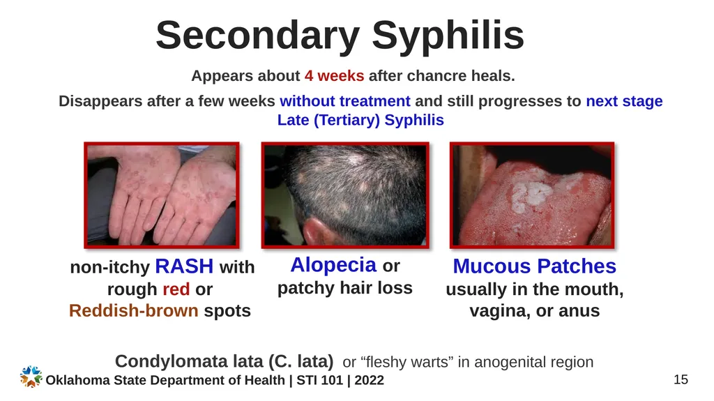 STI/STD STI/STD: True or False? You CANNOT get an - slide 15 of 34