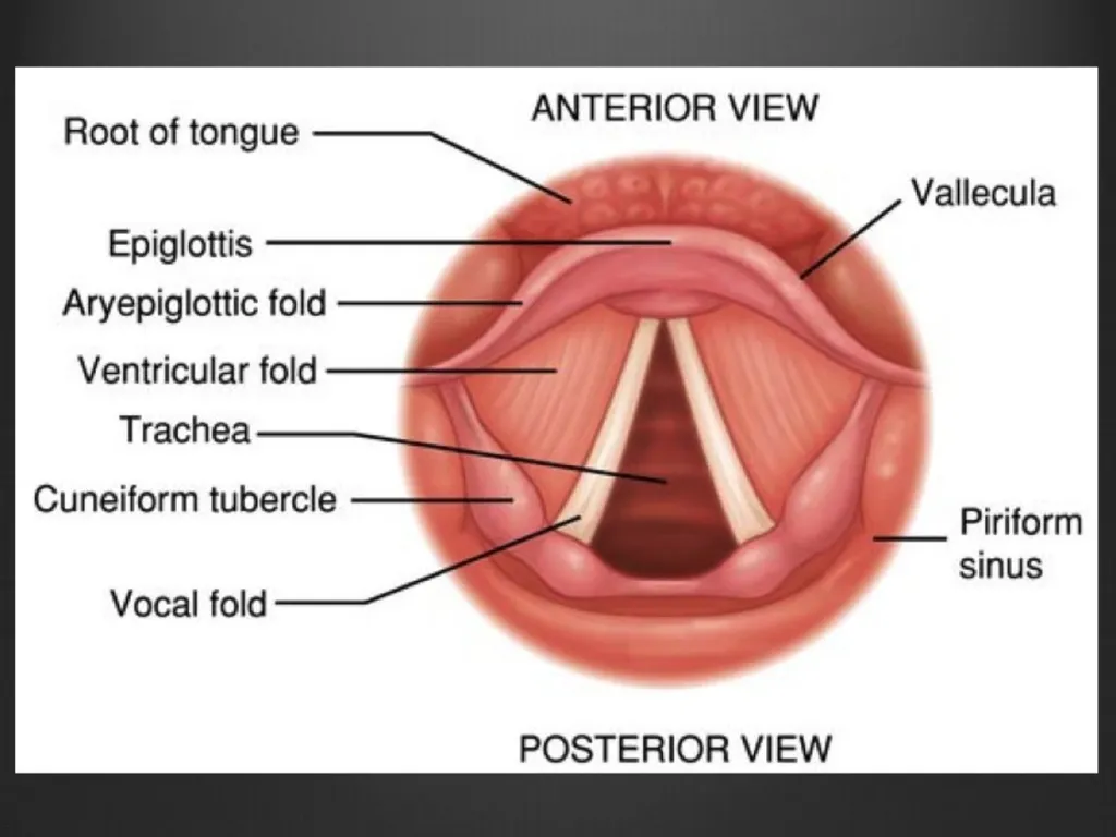 Dysphonia What A GP needs to know This is my - slide 18 of 20