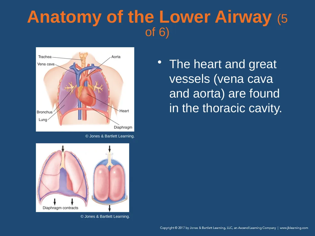 Chapter 10 Airway Management National EMS - slide 24 of 170