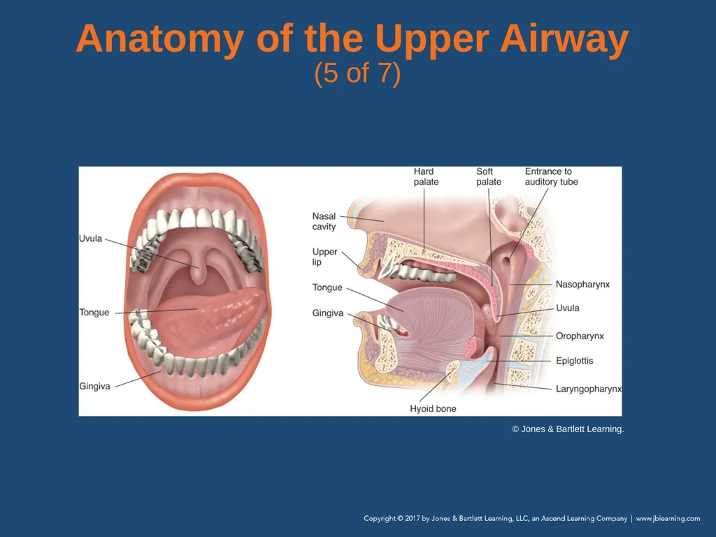 Chapter 10 Airway Management National EMS - slide 17 of 170